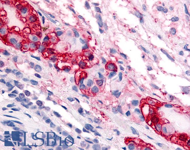 Anti-CRF1 antibody LS-A6603 IHC of human pars intermedia. Immunohistochemistry of formalin-fixed, paraffin-embedded tissue after heat-induced antigen retrieval.
