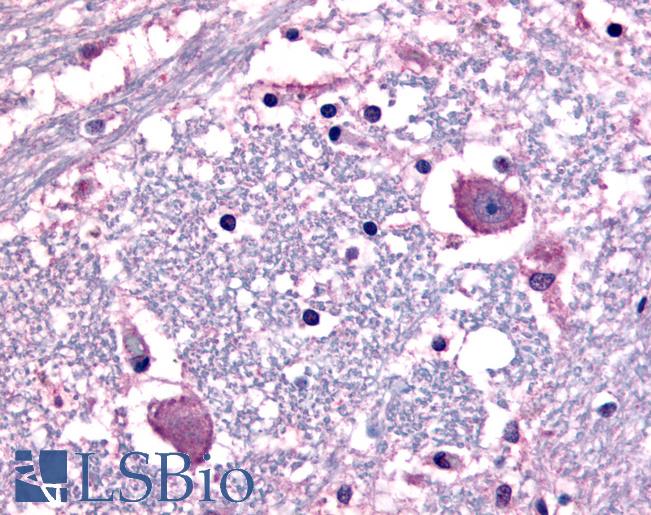 Anti-CRF1 antibody LS-A1779 IHC of human human brain, neurons and glia. Immunohistochemistry of formalin-fixed, paraffin-embedded tissue after heat-induced antigen retrieval.