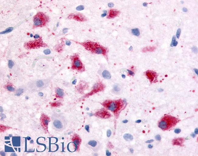 Anti-CRF1 antibody LS-A1779 IHC of rat hypothalalmus. Immunohistochemistry of formalin-fixed, paraffin-embedded tissue after heat-induced antigen retrieval.