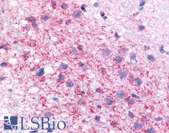 Anti-CRF1 antibody LS-A1778 IHC of rat hypothalamus. Immunohistochemistry of formalin-fixed, paraffin-embedded tissue after heat-induced antigen retrieval.