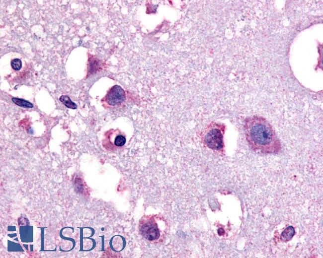 Anti-CRF1 antibody LS-A1778 IHC of human human brain, neurons and glia. Immunohistochemistry of formalin-fixed, paraffin-embedded tissue after heat-induced antigen retrieval.