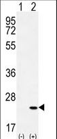 Western blot of CRH (arrow) using rabbit polyclonal CRH Antibody. 293 cell lysates (2 ug/lane) either nontransfected (Lane 1) or transiently transfected (Lane 2) with the CRH gene.