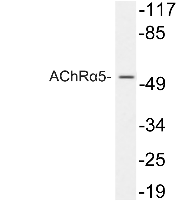 Western blot of AChR alpha 5 antibody in extracts from 293 cells.