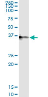 Immunoprecipitation of CRHBP transfected lysate using anti-CRHBP monoclonal antibody and Protein A Magnetic Bead, and immunoblotted with CRHBP rabbit polyclonal antibody.