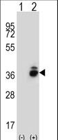 Western blot of CRHBP (arrow) using rabbit polyclonal CRHBP Antibody. 293 cell lysates (2 ug/lane) either nontransfected (Lane 1) or transiently transfected (Lane 2) with the CRHBP gene.