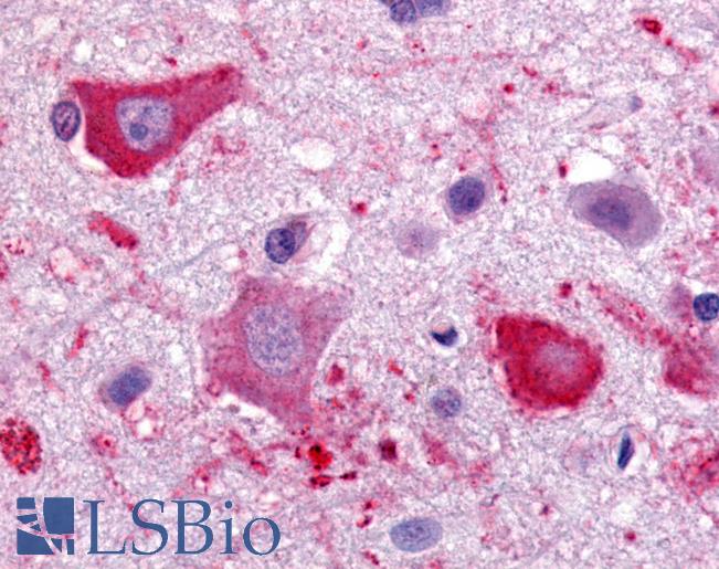 Anti-CMKLR1 antibody LS-A450 IHC of human brain, cortex. Immunohistochemistry of formalin-fixed, paraffin-embedded tissue after heat-induced antigen retrieval.