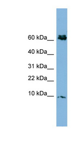 CRIP1 / CRIP antibody LS-C108071 Western blot of PANC1 cell lysate.