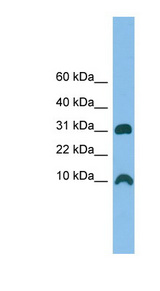 CRIP1 / CRIP antibody LS-C116419 Western blot of THP-1 cell lysate.