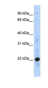 CRIP2 antibody LS-C101494 Western blot of MCF7 cell lysate.