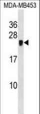 CRIP2 Antibody western blot of MDA-MB453 cell line lysates (35 ug/lane). The CRIP2 antibody detected the CRIP2 protein (arrow).