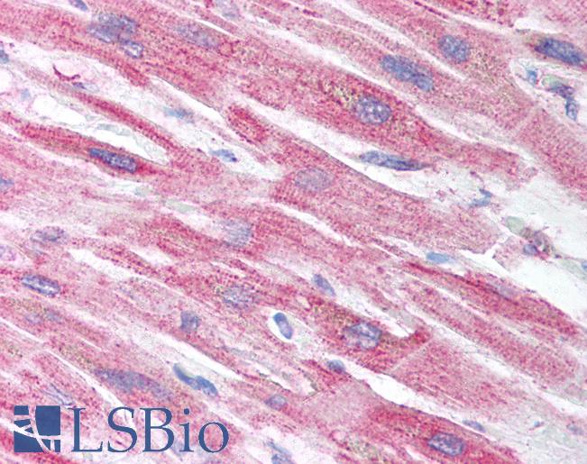 Anti-CRIP2 antibody IHC of human heart. Immunohistochemistry of formalin-fixed, paraffin-embedded tissue after heat-induced antigen retrieval. Antibody LS-B1517 concentration 5 ug/ml.