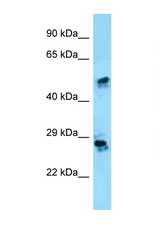 CRISP1 antibody LS-C146425 Western blot of HepG2 Cell lysate. Antibody concentration 1 ug/ml.