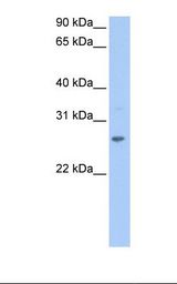 721_B cell lysate. Antibody concentration: 1.0 ug/ml. Gel concentration: 12%.