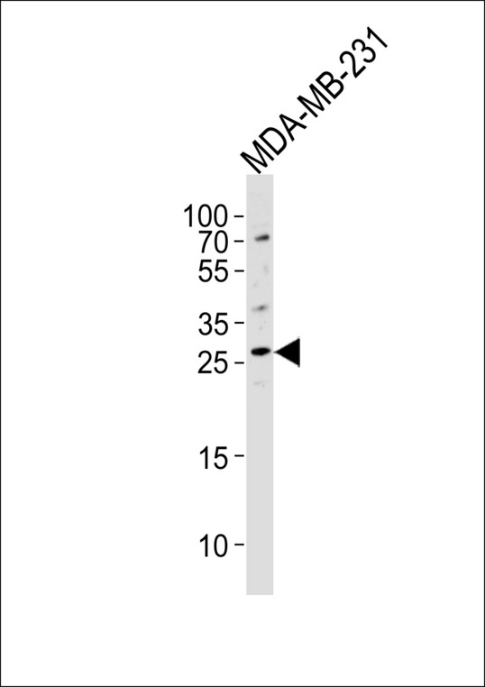 Western blot of lysate from MDA-MB-231 cell line, using CRISP1 Antibody. Antibody was diluted at 1:1000 at each lane. A goat anti-rabbit IgG H&L (HRP) at 1:5000 dilution was used as the secondary antibody. Lysate at 35ug per lane.