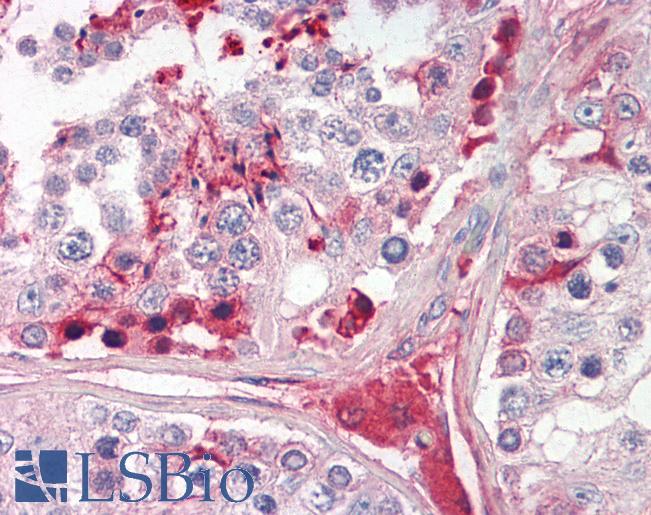 Anti-CRISP-2 / TSP1 antibody IHC of human testis. Immunohistochemistry of formalin-fixed, paraffin-embedded tissue after heat-induced antigen retrieval. Antibody LS-B8317 dilution 3.75 ug/ml.