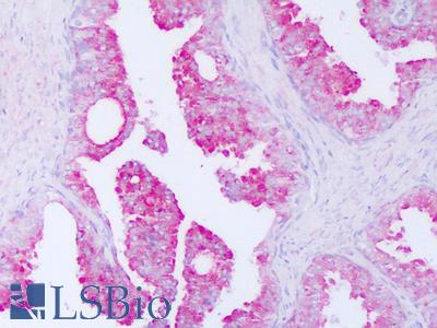Anti-CRISP-3 / SGP28 antibody IHC of human prostate. Immunohistochemistry of formalin-fixed, paraffin-embedded tissue after heat-induced antigen retrieval. Antibody LS-B8285 dilution 5-10 ug/ml.