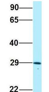 CRISP3 / CRISP-3 antibody Western Blot of Human Placenta. Antibody Dilution: 1.0 ug/ml. Antibody dilution: 1 ug/ml.