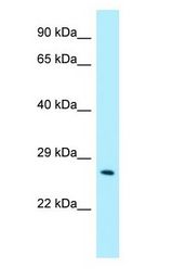 CRISP3 / CRISP-3 antibody Western Blot of Fetal kidney.