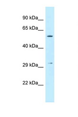 CRISPLD1 antibody LS-C145957 Western blot of Fetal Liver lysate. Antibody concentration 1 ug/ml.