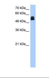 Jurkat cell lysate. Antibody concentration: 1.0 ug/ml. Gel concentration: 12%.