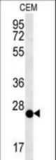 CRISPLD2 Antibody western blot of CEM cell line lysates (15 ug/lane). The CRISPLD2 antibody detected the CRISPLD2 protein (arrow).