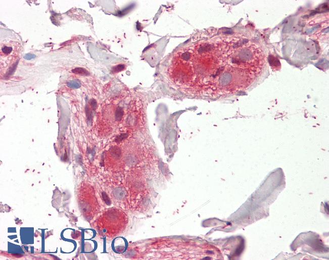 Anti-CHRNA5 antibody IHC of human colon, submucosal plexus. Immunohistochemistry of formalin-fixed, paraffin-embedded tissue after heat-induced antigen retrieval. Antibody LS-B8364 dilution 3.75 ug/ml.