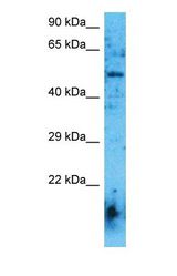 Western blot of ACHA6 Antibody with human Fetal Kidney lysate.