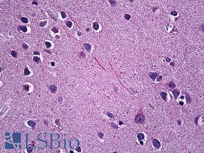 Anti-CHRNA6 antibody IHC of human brain, cortex. Immunohistochemistry of formalin-fixed, paraffin-embedded tissue after heat-induced antigen retrieval. Antibody LS-B6133 concentration 5 ug/ml.