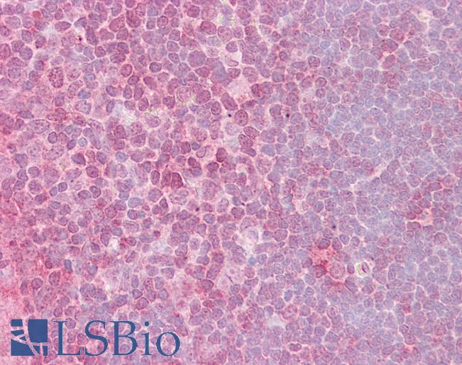 Anti-CRKL antibody IHC of human thymus. Immunohistochemistry of formalin-fixed, paraffin-embedded tissue after heat-induced antigen retrieval. Antibody LS-B6441 concentration 2.5 ug/ml.