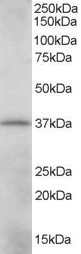 (0.01 ug/ml) Staining of K562 lysate (35 ug protein in RIPA buffer). Primary incubation was 1 hour. Detected by chemiluminescence.