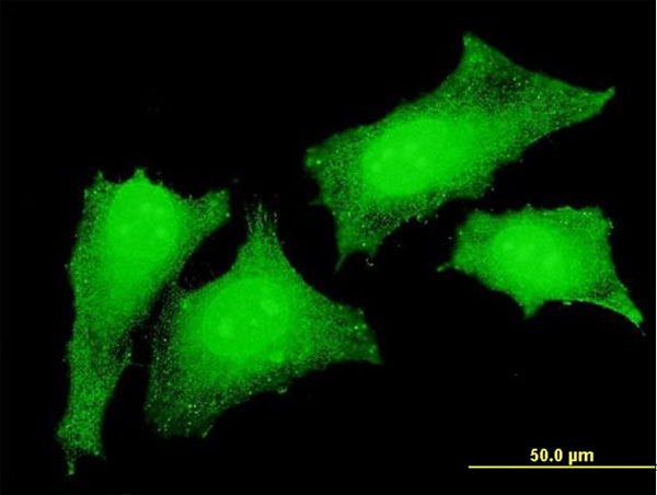 Immunofluorescence of monoclonal antibody to CRKL on HeLa cell . [antibody concentration 10 ug/ml]