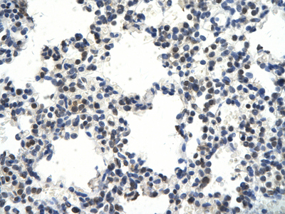 CRKL antibody Western Blot of Human Lung cell. Cellular Data: Epithelial cells of renal tubule. Antibody Concentration: 4.