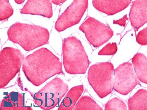 Anti-CRLF1 antibody IHC staining of human skeletal muscle. Immunohistochemistry of formalin-fixed, paraffin-embedded tissue after heat-induced antigen retrieval.