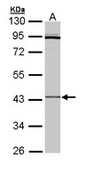 Sample (30 ug of whole cell lysate). A: Hep G2 . 10% SDS PAGE. CRLF1 antibody diluted at 1:3000