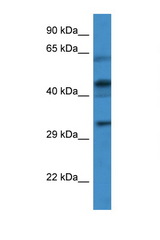 CRLF1 antibody LS-C145593 Western blot of Jurkat Cell lysate. Antibody concentration 1 ug/ml.