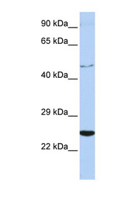CRLF1 antibody LS-C110190 Western blot of Jurkat lysate.