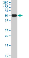 CRLF1 monoclonal antibody (M02), clone 5C2. Western blot of CRLF1 expression in HeLa.