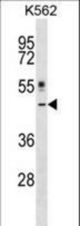 CRLF1 Antibody western blot of K562 cell line lysates (35 ug/lane). The CRLF1 antibody detected the CRLF1 protein (arrow).