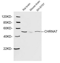 Western blot of cell and tissue lysates using 1 ug/ml Rabbit Anti-CHRNA7 Polyclonal Antibody. The signal was developed with IRDye 800 Conjugated Goat Anti-Rabbit IgG. Predicted Size: 56 KD. Observed Size: 56 KD.