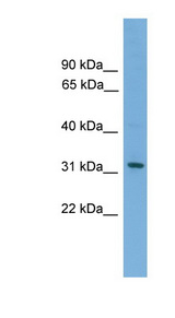 CRLF2 antibody LS-C116273 Western blot of 721_B cell lysate.