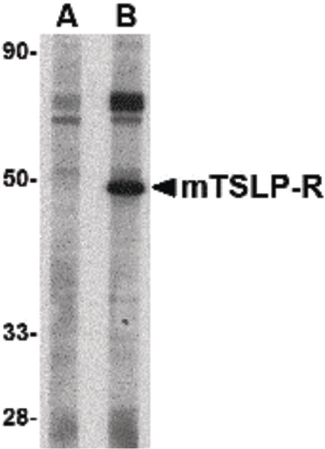 Western blot of TSLP Receptor in mouse heart tissue lysate with TSLP Receptor antibody at 1 ug/ml in (A) the presence and (B) the absence of blocking peptide.