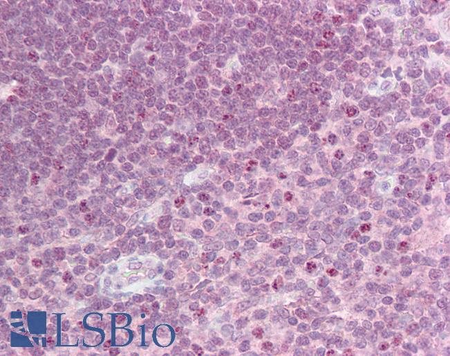 Anti-CRLF2 antibody IHC of human thymus. Immunohistochemistry of formalin-fixed, paraffin-embedded tissue after heat-induced antigen retrieval. Antibody LS-B6755 concentration 10 ug/ml.