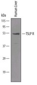 TSLP R in Human Liver. TSLP R was detected in immersion fixed paraffin-embedded sections of human liver using Goat Anti-Human TSLP R Antigen Affinity-purified Polyclonal Antibody at 15 ug/ml overnight at 4°C. Tissue was stained using Anti-Goat HRP-DAB (brown) and counterstained with hematoxylin (blue).