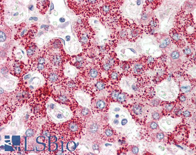 Anti-CRLF2 antibody IHC of human liver. Immunohistochemistry of formalin-fixed, paraffin-embedded tissue after heat-induced antigen retrieval. Antibody LS-B3211 concentration 5 ug/ml.