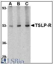 Western blot of TSLP Receptor in human liver tissue lysate with LS-B3211 at (A) 0.5, (B) 1 and (C) 2 ug/ml.