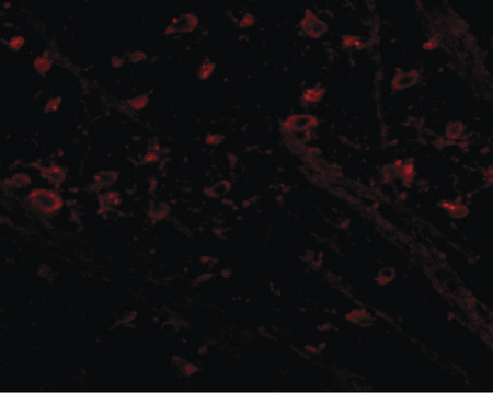 Immunofluorescence of CRMP1 in mouse brain tissue with CRMP1 antibody at 5 ug/ml.