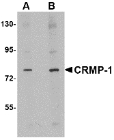 Western blot of CRMP1 in rat brain tissue lysate with CRMP1 antibody at (A) 1 and (B) 2 ug/ml.