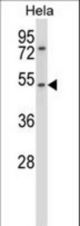 CHRNA7 Antibody western blot of HeLa cell line lysates (35 ug/lane). The CHRNA7 antibody detected the CHRNA7 protein (arrow).