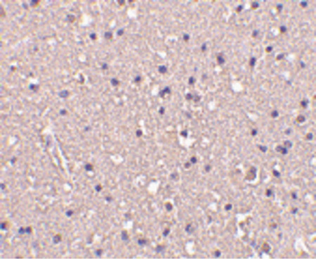 Immunohistochemistry of CRMP1 in human brain tissue with CRMP1 antibody at 10 ug/ml.