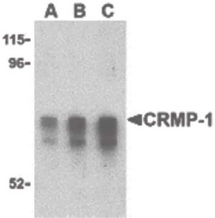 Western blot of CRMP1 in Caco-2 cell lysate with CRMP1 antibody at (A) 1, (B) 2 and (C) 4 ug/ml.